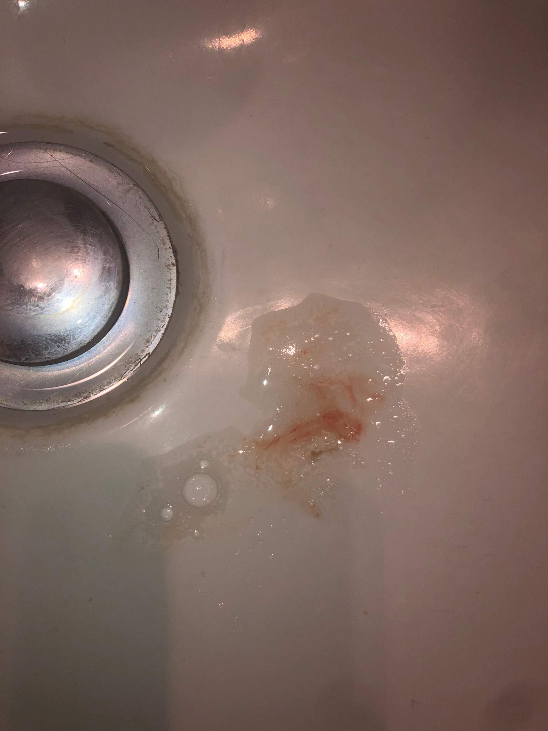 Blut Im Speichel Ist Das Gefahrlich Gesundheit Und Medizin Blut Im Speichel Ist Das Gefahrlich Gesundheit Und Medizin