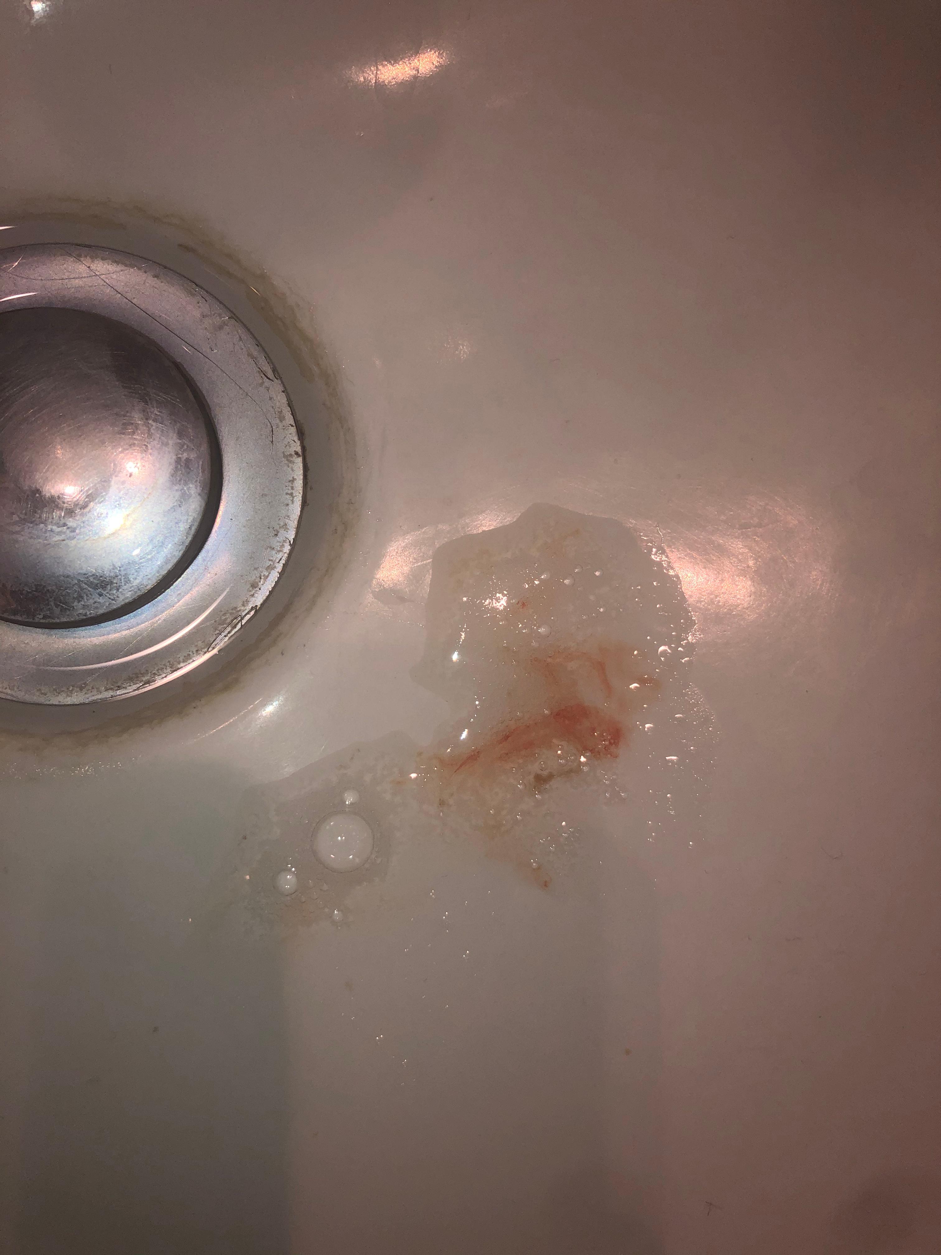 Blut Im Speichel Ist Das Gefahrlich Gesundheit Und Medizin Blut Im Speichel Ist Das Gefahrlich Gesundheit Und Medizin