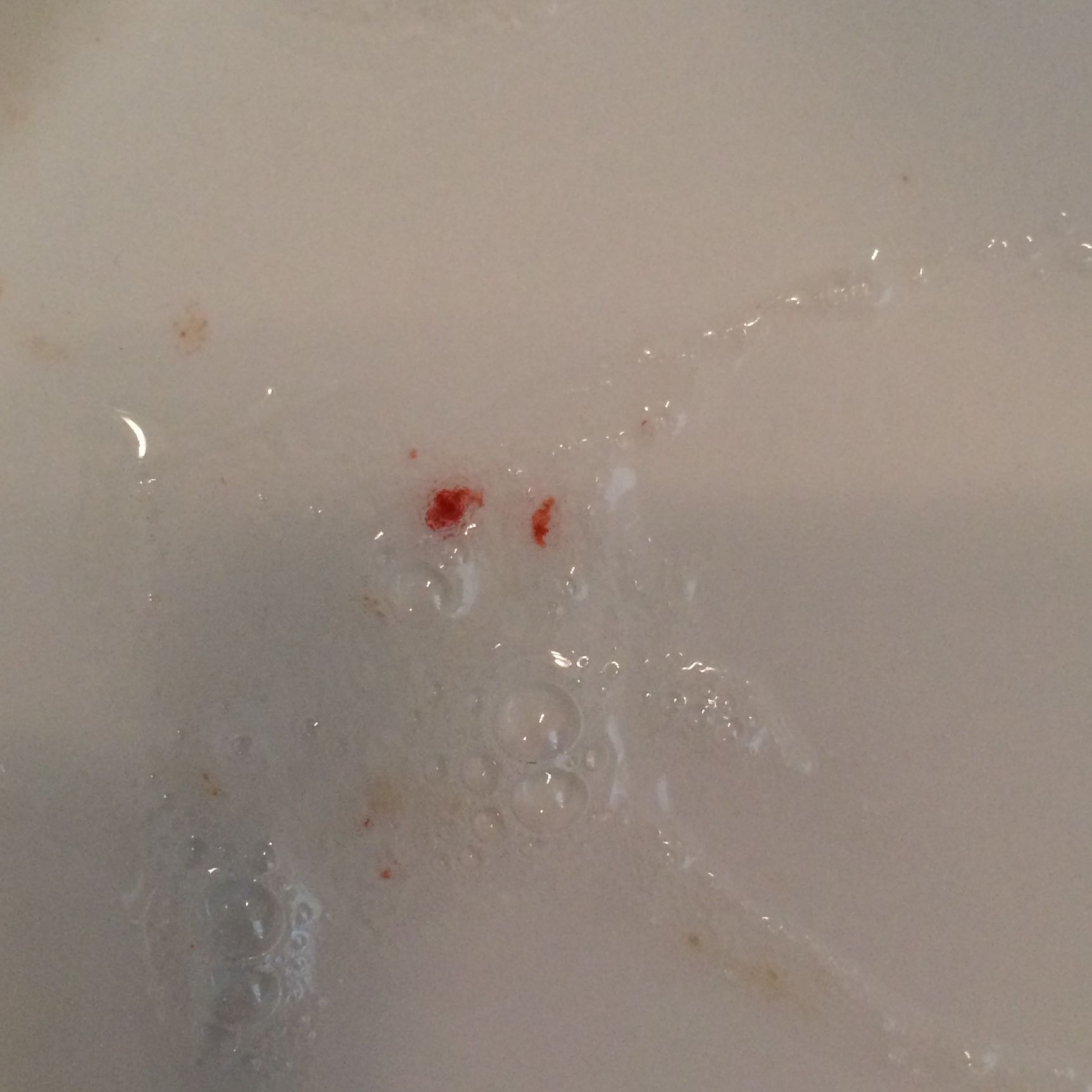 Blut im Speichel siehe Bild , Hilfe? (Arzt, Krebs, Lunge)
