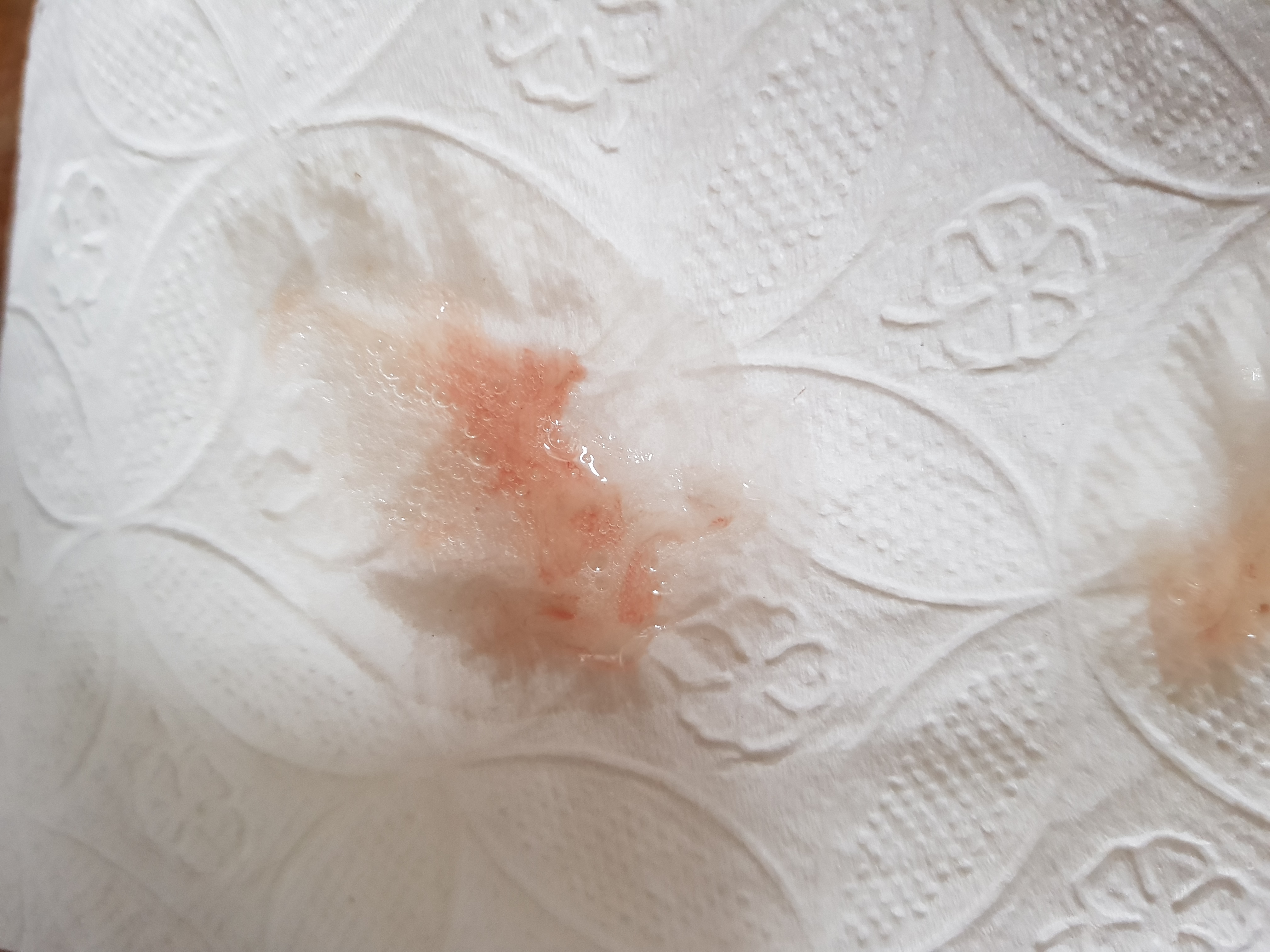 Blut Im Speichel Was Kann Es Sei Blut Im Speichel Was Kann Es Sei