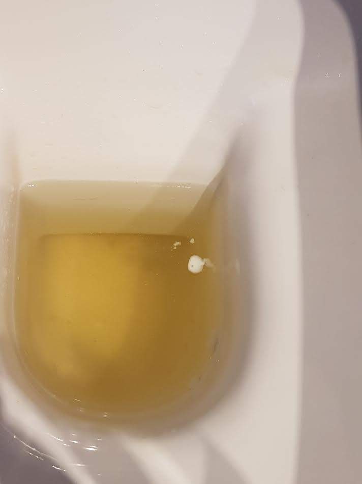 Urin im weiße fetzen Fusseln im