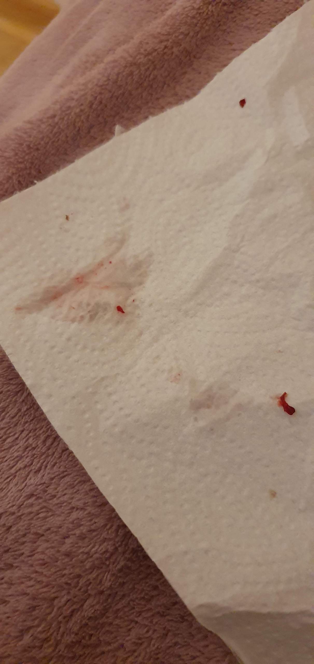 Blut kommt aus nase wenn schnupfen rauspusten? (Gesundheit und Medizin