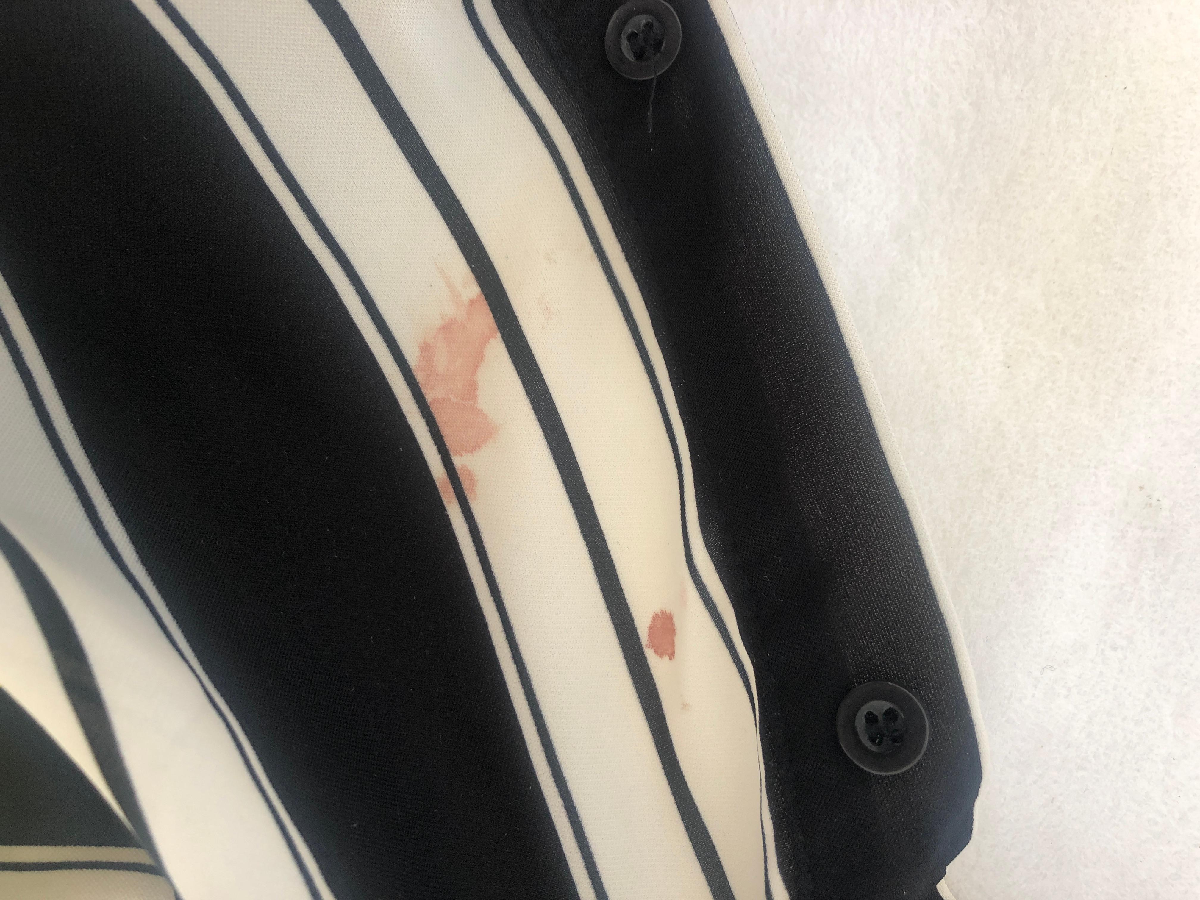 Bekommt Man Acrylfarbe Aus Klamotten Raus