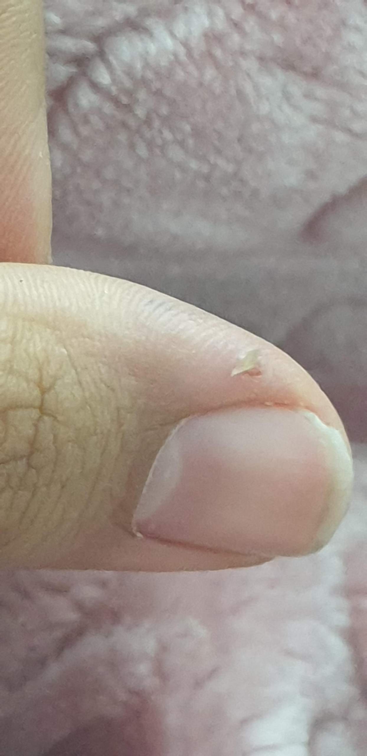 Blutige Finger und Risse was kann das sein? (Haut) Blutige Finger und Risse was kann das sein? (Haut)