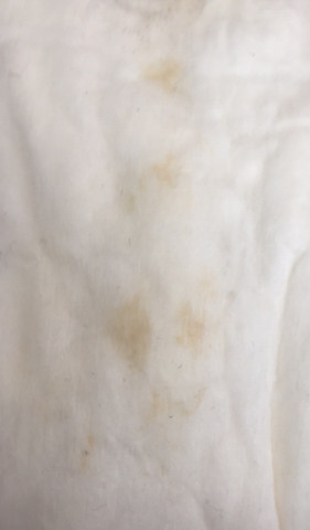 Blutung Oder Ausfluss Bin In Der 6ssw Blutung Oder Ausfluss Bin In Der 6ssw