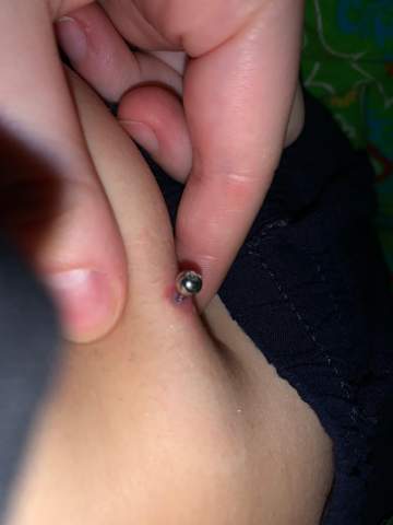 bnp entzundet und eitert piercing bauchnabelpiercing