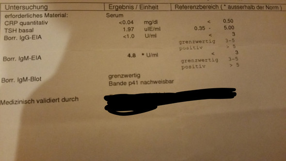 Borreliose Blutwerte Was Sagen Sie Aus Bluttest Blutbild Blutwerte Auswerten Borreliose Blutwerte Was Sagen Sie Aus Bluttest Blutbild Blutwerte Auswerten