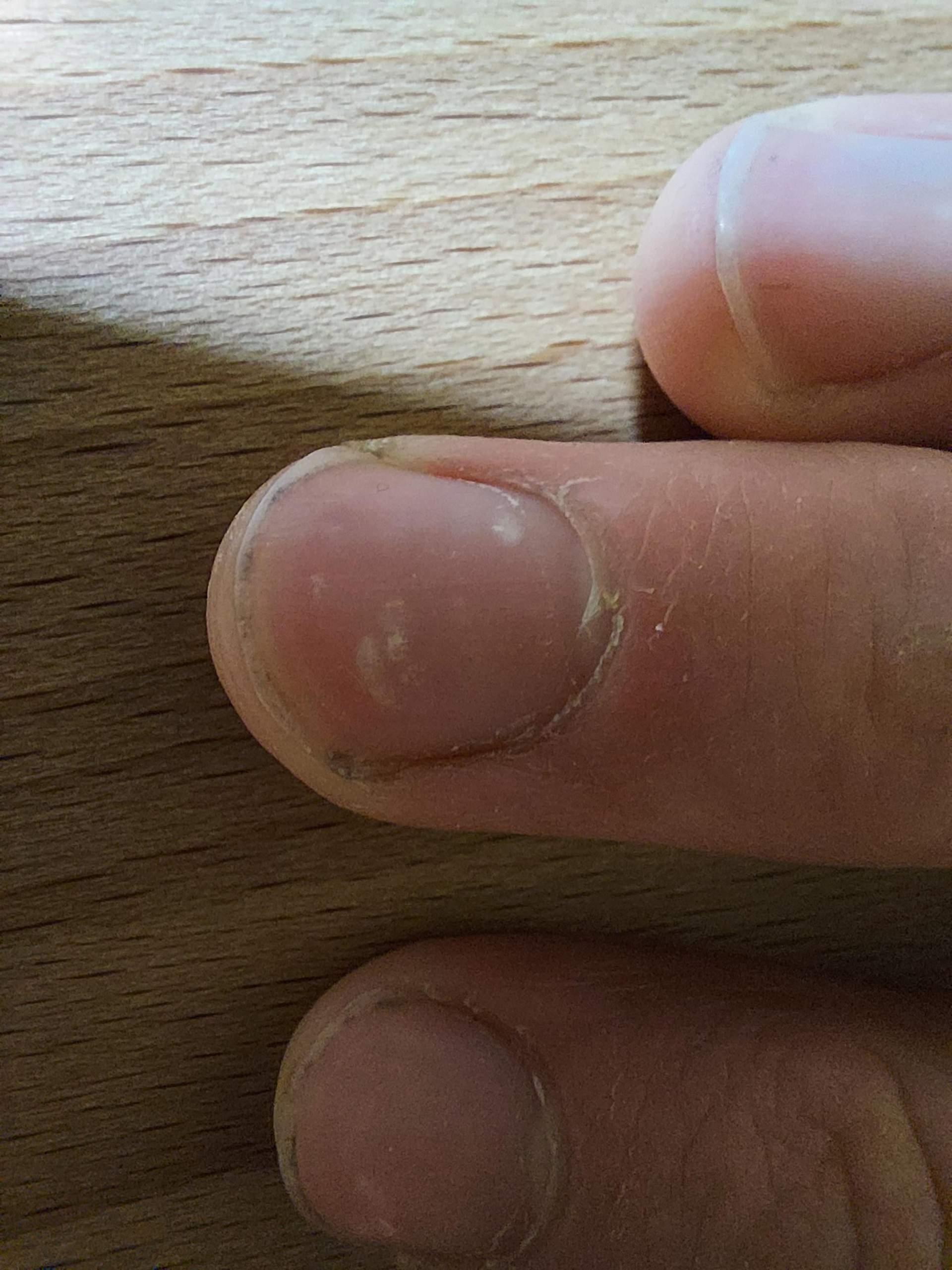 Brauche Tipps für die Nagelpflege (Jungs)? (Beauty, Style, Nägel)