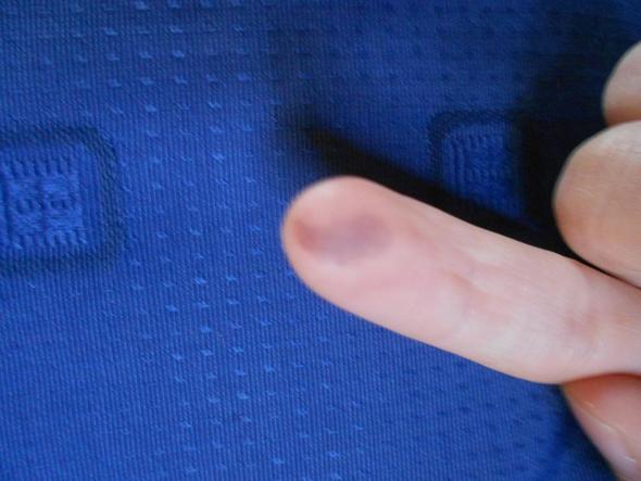 Zeigefinger - (Krankheit, Flecken)