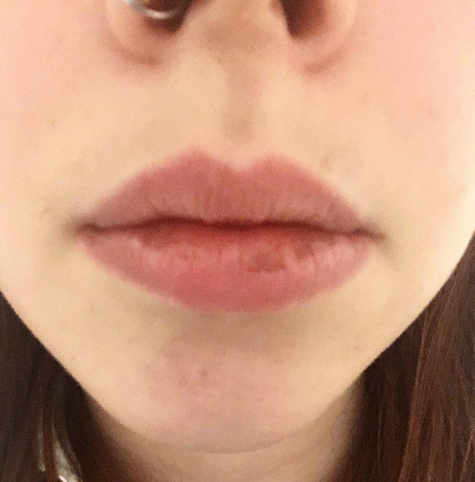 Braune Flecken auf den Lippen ( Raucher )? (Gesundheit und Medizin, rauchen)