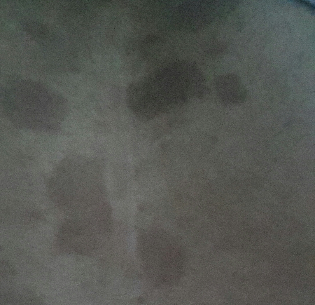 Braune Flecken auf der brust? (Gesundheit, Hautprobleme) Braune Flecken auf der brust? (Gesundheit, Hautprobleme)