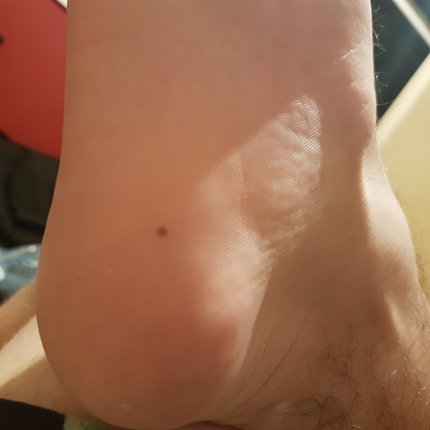 Bild - (Füße, Hautarzt, Dermatologie)