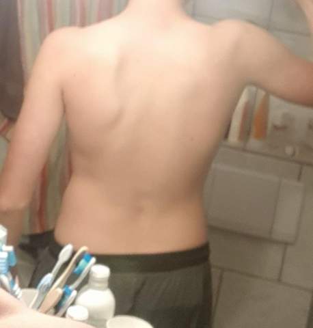 Mann tun becken breites was Weiblicher Körperbau