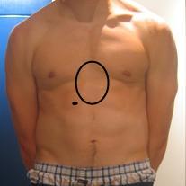 Brennen Kitzeln Im Oberbauch Brust Was Konnte Das Sein Arzt Krankheit Schmerzen Brennen Kitzeln Im Oberbauch Brust Was Konnte Das Sein Arzt Krankheit Schmerzen