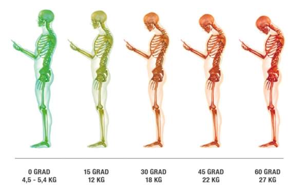Bringen Ubungen Gegen Einen Rundrucken Was Gesundheit Und Medizin Sport Korper