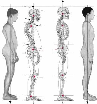 Rücken - (Biologie, Rücken, krumm)