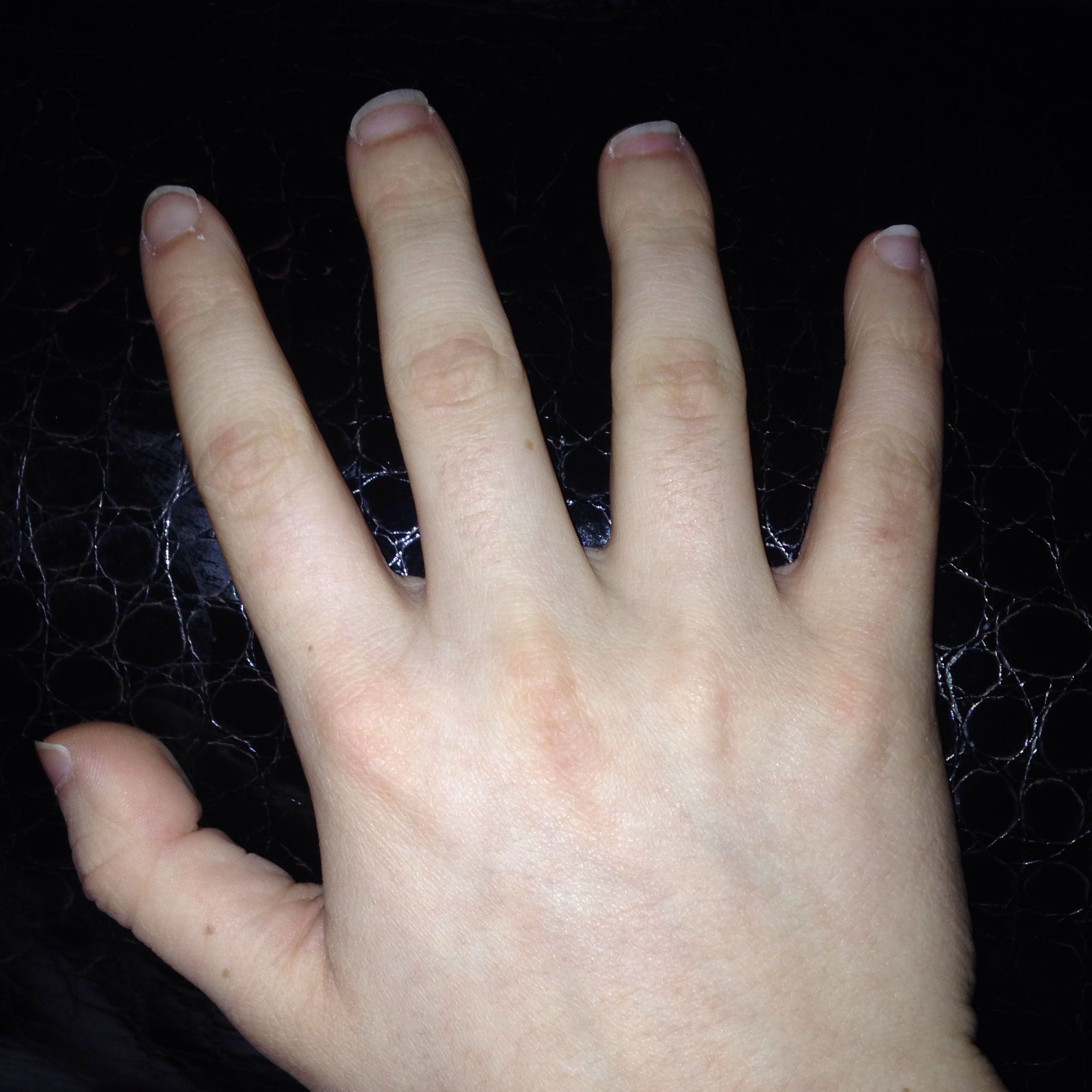 Ch Bin Nicht Mit Meine Hande Zufrieden Sehen Schrecklich Aus Oder Bin Ein Madchen Und 14 Hand