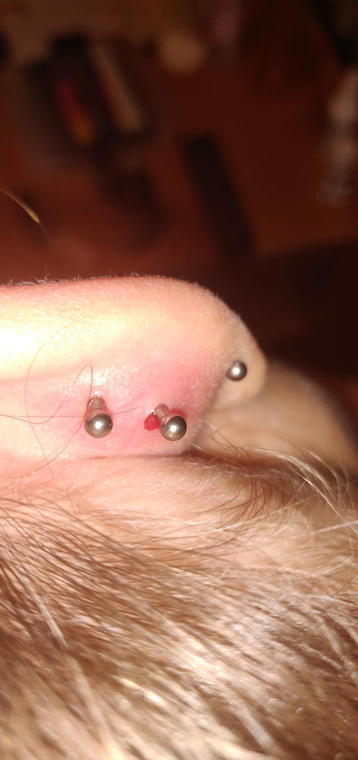 Conch piercing migration? (Piercer)