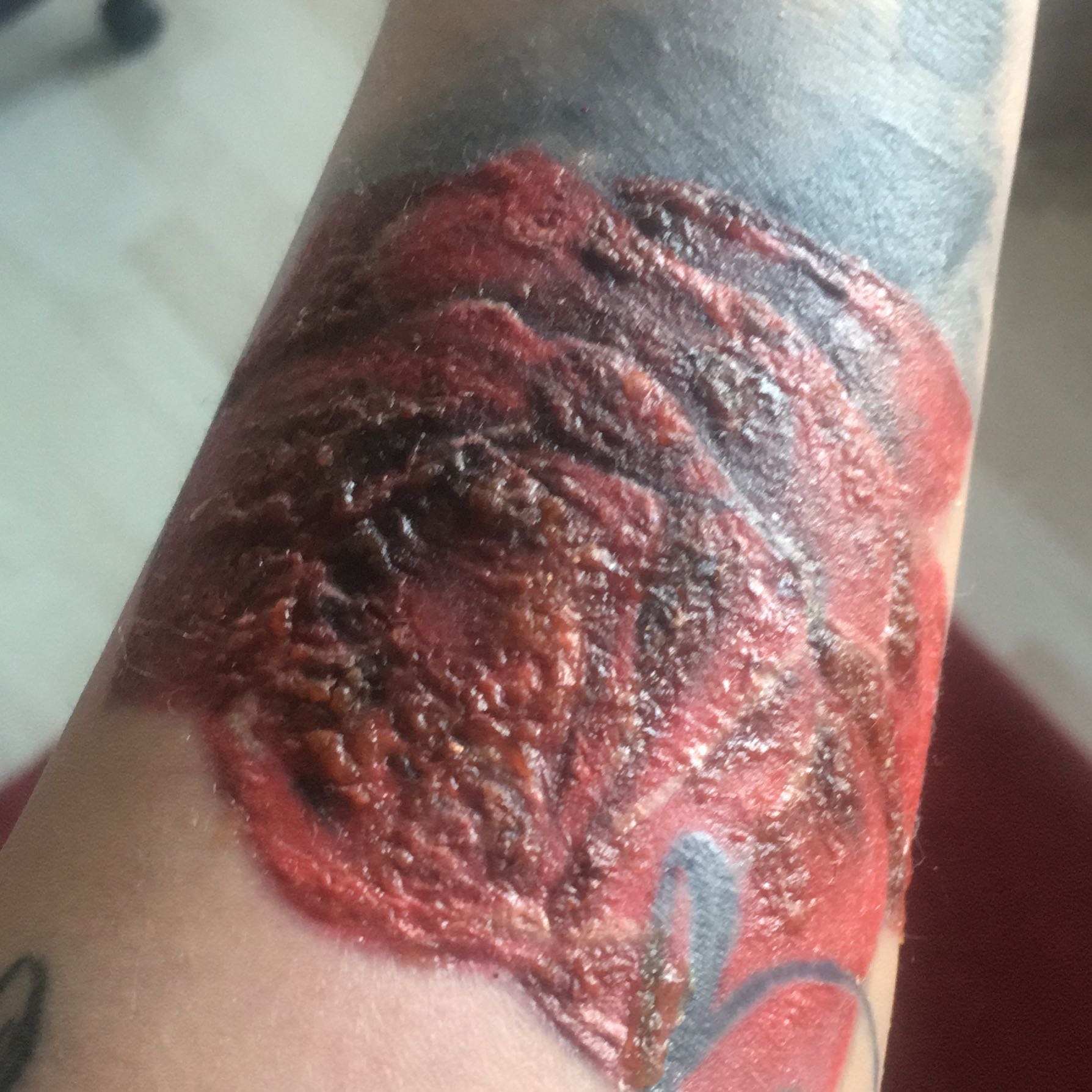 Coverup Tattoo, ist das normal? (Gesundheit und Medizin, Wunde, Abteilung)