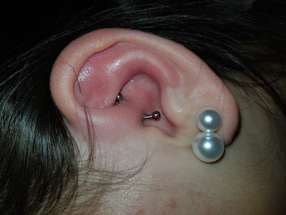 Daith Piercing Entzundet Was Jetzt Gesundheit Und Medizin Entzundung