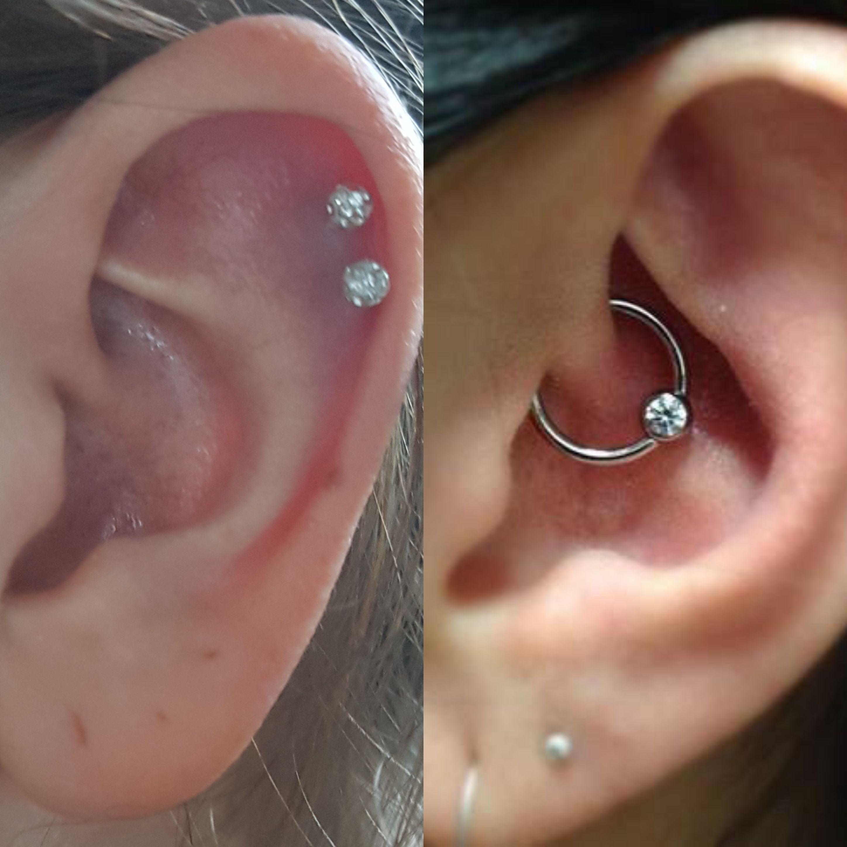 Daith Piercing Nicht Moglich