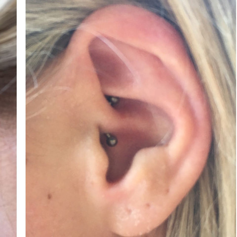 So sah es direkt nach dem stechen aus.  - (Schmerzen, Piercing, daith)