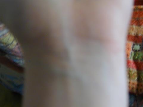 hand bereich - (blutabnahme, Besserwisser)