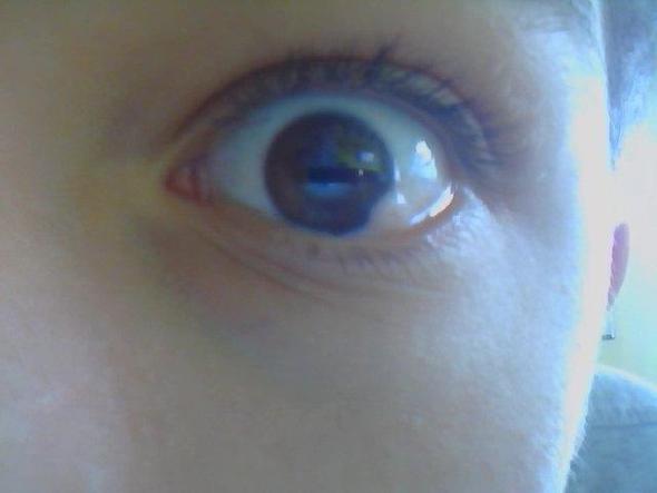 linkes Auge ( hoffe man erkennt es rechts unten) - (Medizin, Arzt, Krankheit)