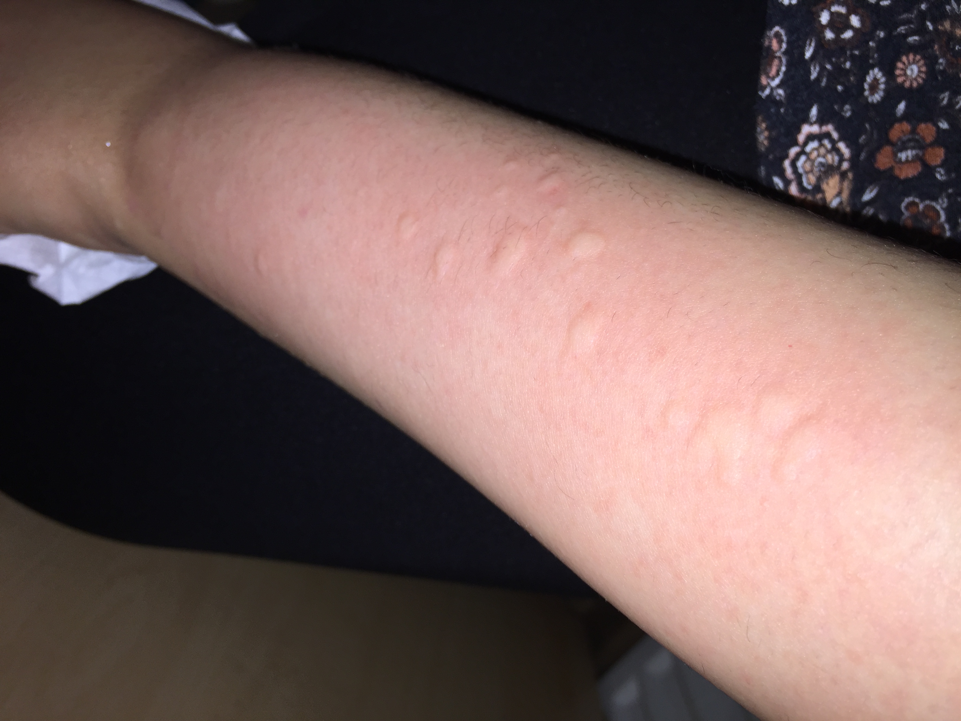 rasieren bzw wachsen passiert