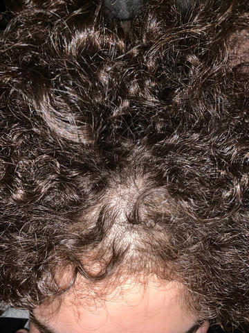 dauer welle haarausfall dauerwelle