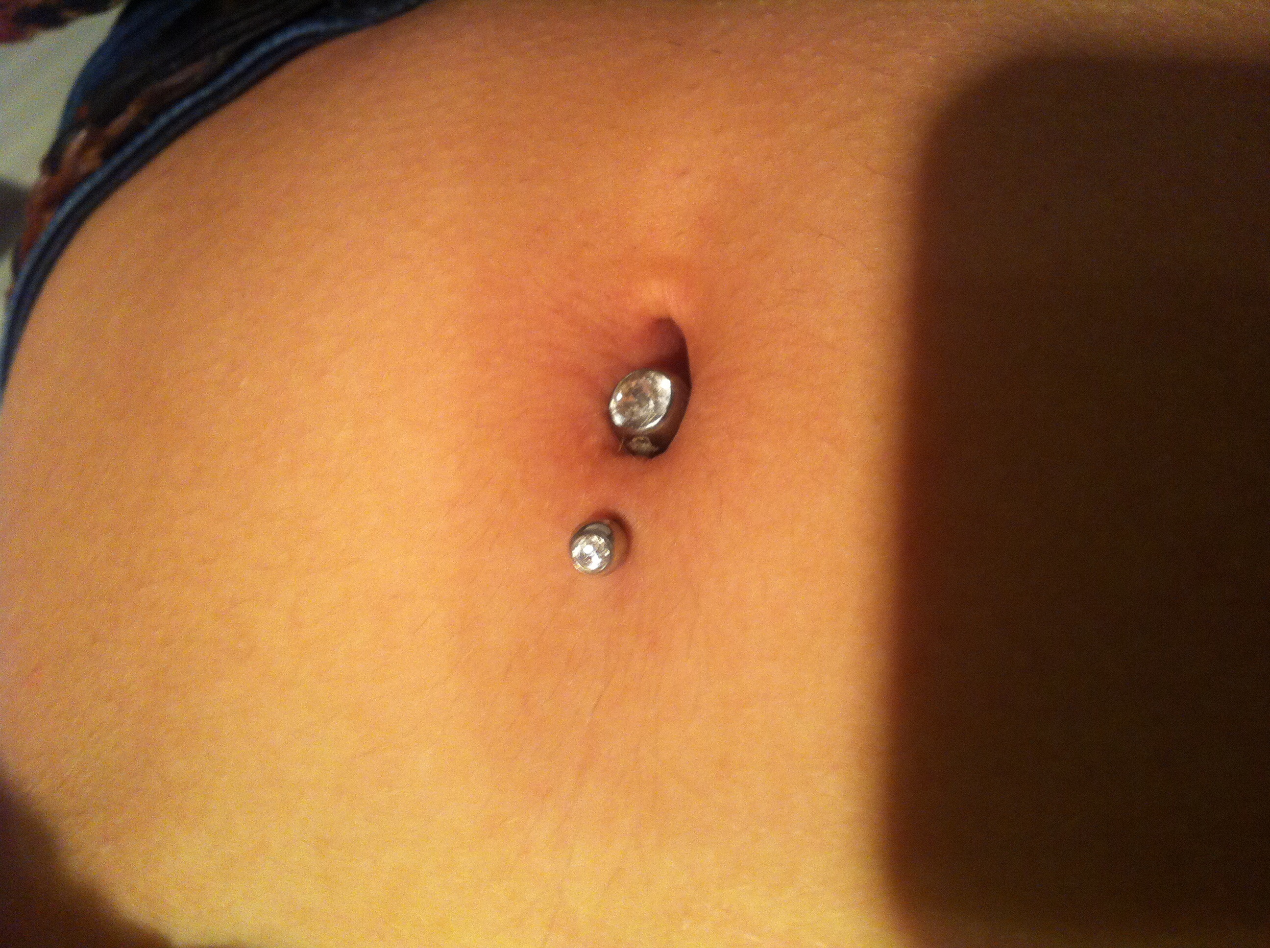 Dauerhaftes Wundsekret Bauchnabelpiercing Dauerhaftes Wundsekret Bauchnabelpiercing