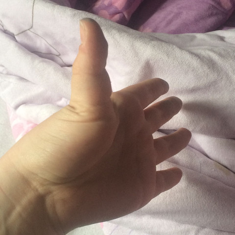 Daumen Verbiegbar 2 0 Hand Finger Gelenke Daumen Verbiegbar 2 0 Hand Finger Gelenke