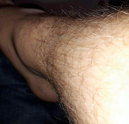 Bein - (Beinhaare, Beinbehaarung)