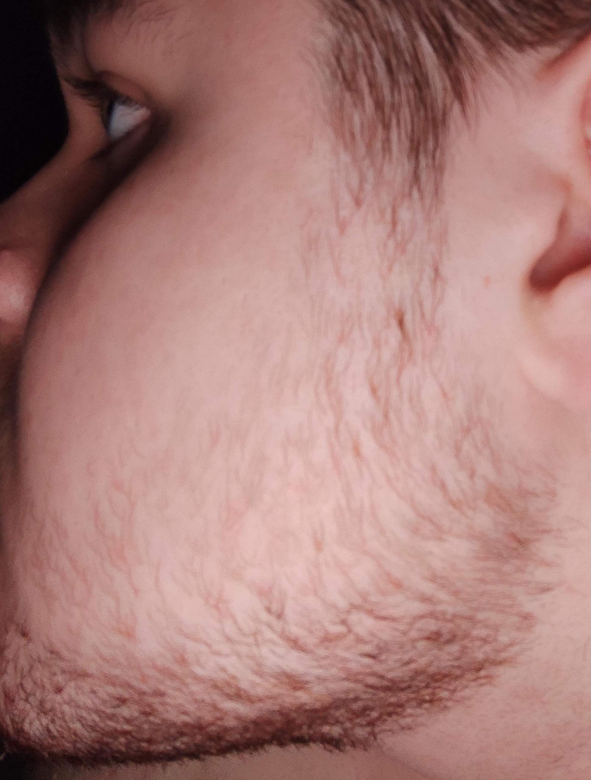 Denkt Ihr aus dem Bartwuchs kann irgendwann ein Vollbart werden