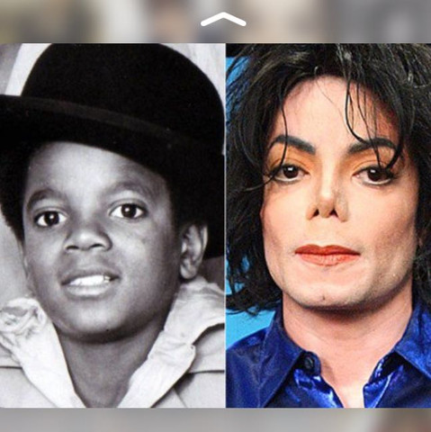 Bild 2 - (Schönheitsoperation, Michael Jackson)