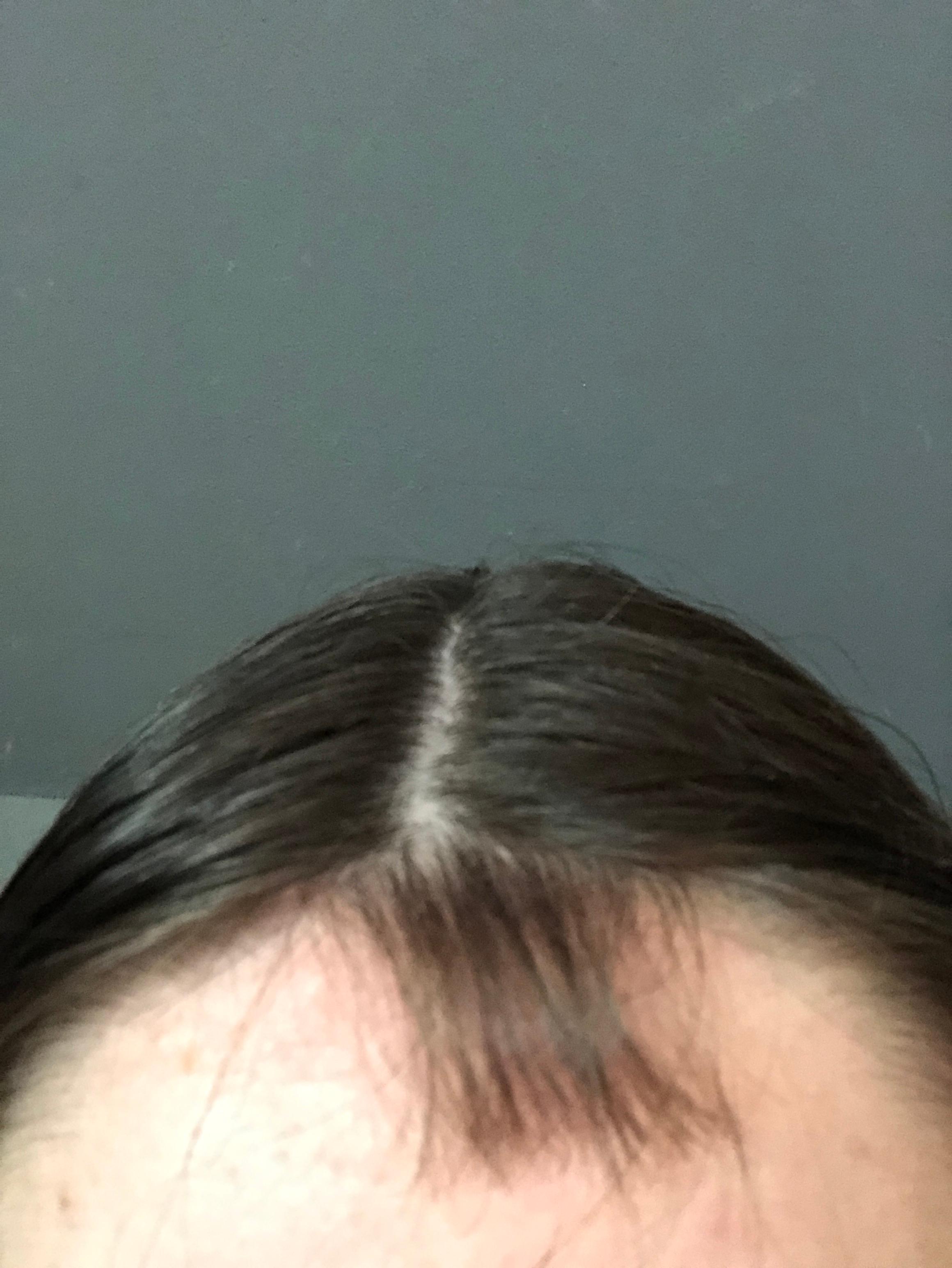 dicke babyhaare an stirn bzw am ansatz