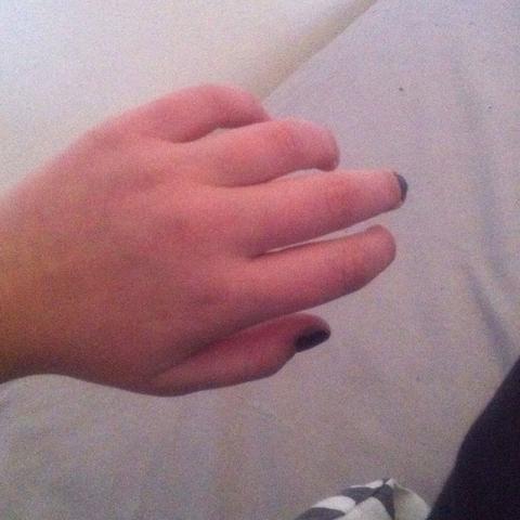 Warum habe ich dicke finger