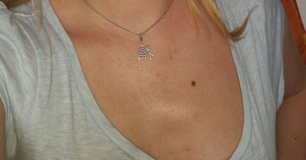 Dickere Rippe über Brust (Krebs, Knochen, Tumor) Dickere Rippe über Brust (Krebs, Knochen, Tumor)