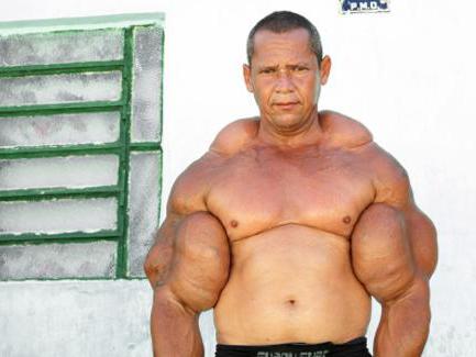 Steroide nebenwirkungen bodybuilding