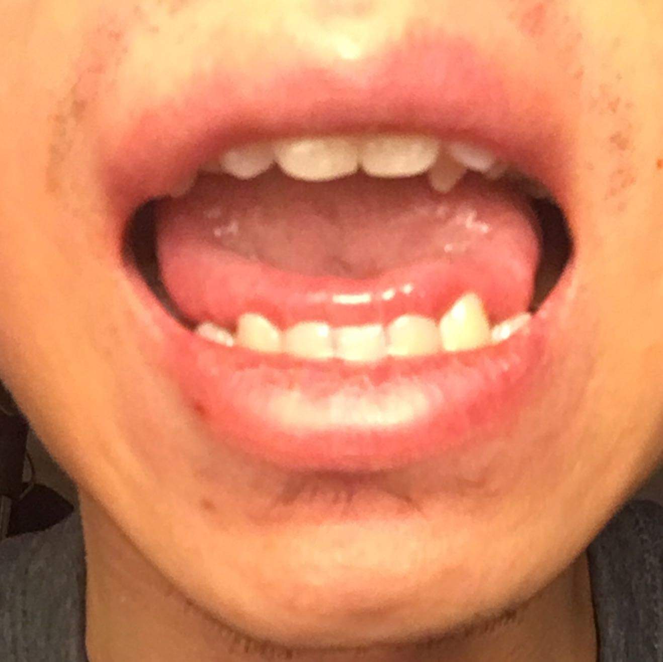 die Zungenstelle von ch wie ich sieht sie so aus die Zungenstelle von ch wie ich sieht sie so aus