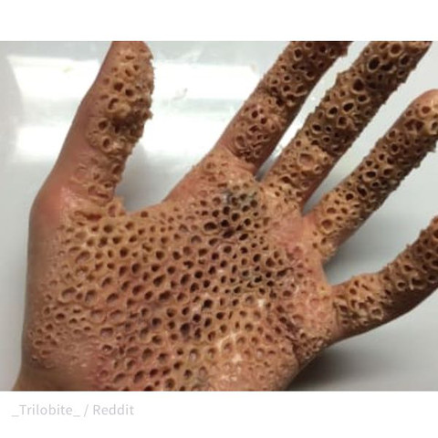 Dieses Bild Macht Mir Angst Wieso Hand Phobie Loch Dieses Bild Macht Mir Angst Wieso Hand Phobie Loch