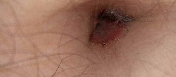 Myprettynavelbellybutton - (Hygiene, tief, nabel)