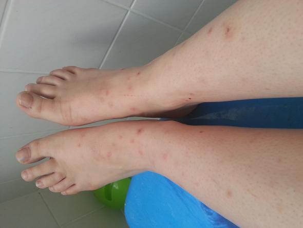 Dringende Hilfe Zu Katzenflohen Gesucht Menschen Katze Parasiten Dringende Hilfe Zu Katzenflohen Gesucht Menschen Katze Parasiten