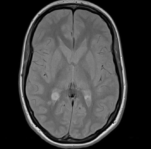 1 MRT- Bild - (Gesundheit, Krankheit)