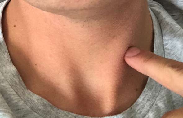 Druck Am Hals Verspannung Gesundheit Und Medizin Erkaltung Halsschmerzen Druck Am Hals Verspannung Gesundheit Und Medizin Erkaltung Halsschmerzen