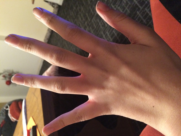 Dünne finger - (Gesundheit, Finger, dünn)