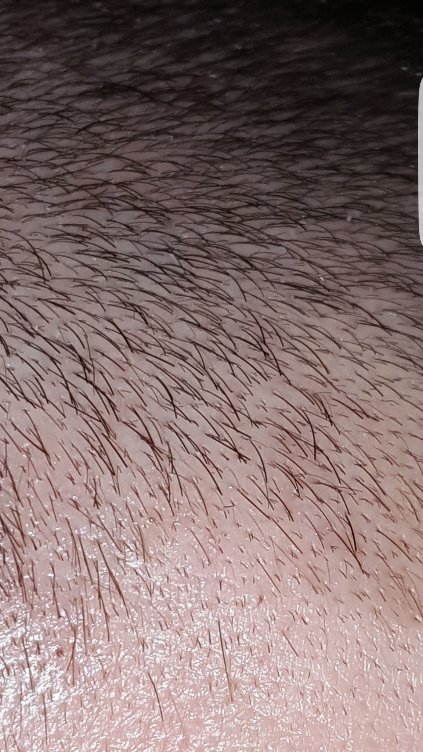 dunne kurze haare wachsen langsam mann