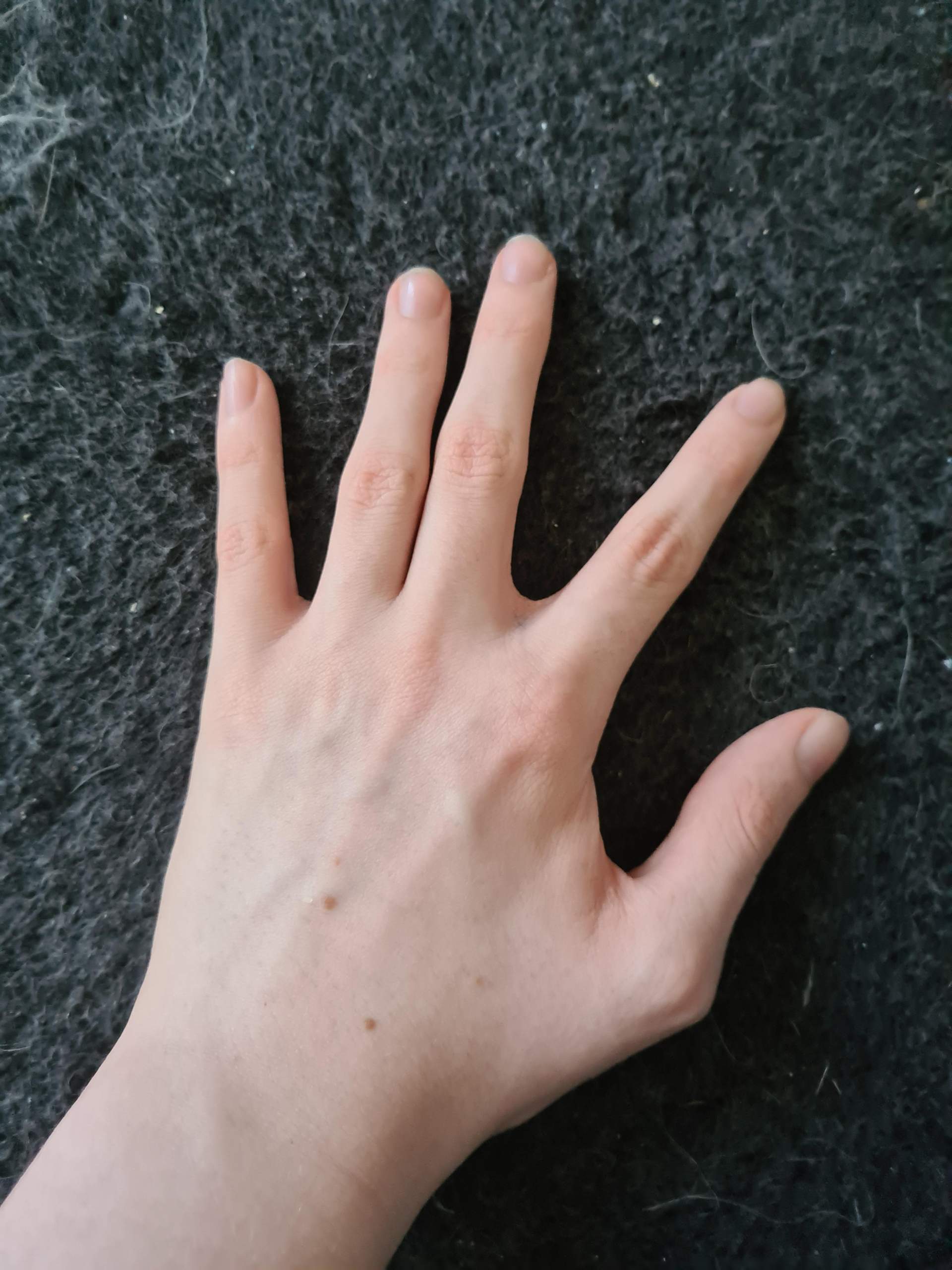 Dünne und kleine Hände als 16 jähriger? (Gesundheit und Medizin, Hand)