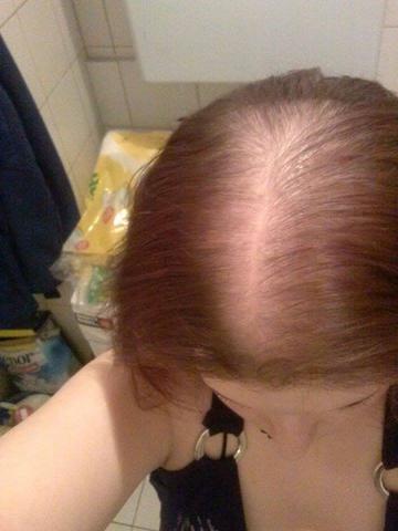 Ich - (dünnes Haar, haarprobleme, lichtes Haar)