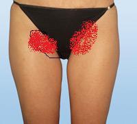 dunkle haare an oberschenkeln neben